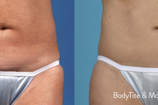 File Name : DSC_0078.JPG
 File Size : 1.1MB (1139811 bytes)
 Date Taken : Thu, Apr 3, 2003 5:40:08 AM
 Image Size : 2000 x 1312 pixels
 Resolution : 300 x 300 dpi
 Bit Depth : 8 bits/channel
 Protection Attribute : Off
 Camera ID : N/A
 Camera : NIKON D1X
 Quality Mode : FINE
 Metering Mode : Matrix
 Exposure Mode : Manual
 Speed Light : No
 Focal Length : 52.0 mm
 Shutter Speed : 1/125 seconds
 Aperture : F20.0
 Exposure Compensation : 0.0 EV
 White Balance : Preset3
 Lens : 28-105 mm F3.5-F4.5
 Flash Sync Mode : N/A
 Exposure Difference : -9.4 EV
 Flexible Program : No
 Sensitivity : ISO125
 Sharpening : Normal
 Image Type : Color
 Color Mode : Mode I (sRGB)
 Hue Adjustment : 3
 Saturation Control : N/A
 Tone Compensation : Normal
 Latitude(GPS) : N/A
 Longitude(GPS) : N/A
 Altitude(GPS) : N/A